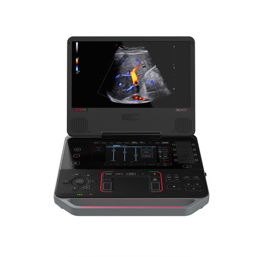 便携式B超机 - MyLab™C30 GTS - Esaote/百胜 - 用于术前超声检查 / 彩色多普勒 / 3D/4D