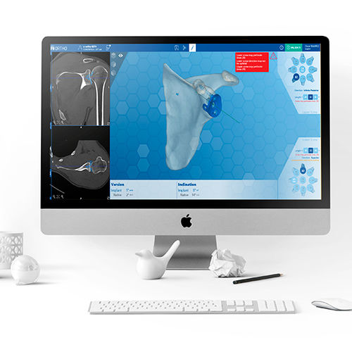 肩关节手术软件 - e-Ortho - FH Orthopedics - 3D 可视化 / 用于检查假体 / 解剖学