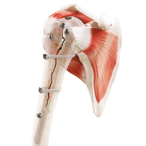关节周围骨折骨科环扎线 - Strapflex - FH Orthopedics - 聚合物复丝