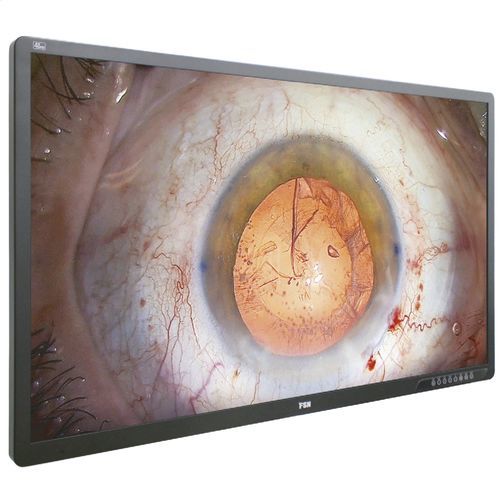 医用显示器 - FM-A5505DGC - FSN Medical Technologies/费斯托 - 内窥镜 / 手术 / 全高清Full HD