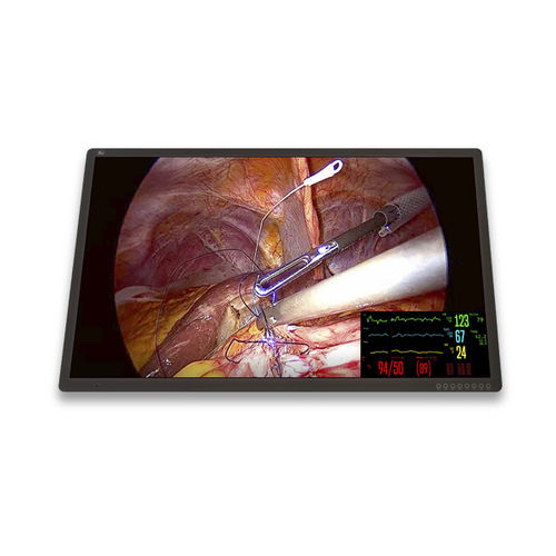 医用显示器 - FM-C5501DV - FSN Medical Technologies/费斯托 - 手术 / 3840 × 2160 / 55"