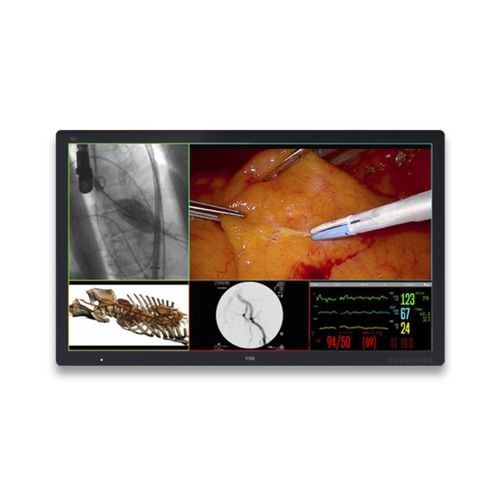 医用显示器 - FM-D5802DV - FSN Medical Technologies/费斯托 - 手术 / 医学成像 / 诊断
