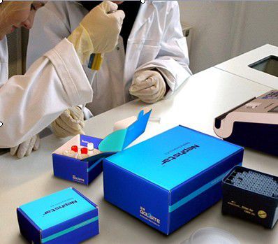 多功能试剂 - Nephstar  - Goldsite Diagnostics Inc. - 蛋白质 / IgA / IgG免疫球蛋白G
