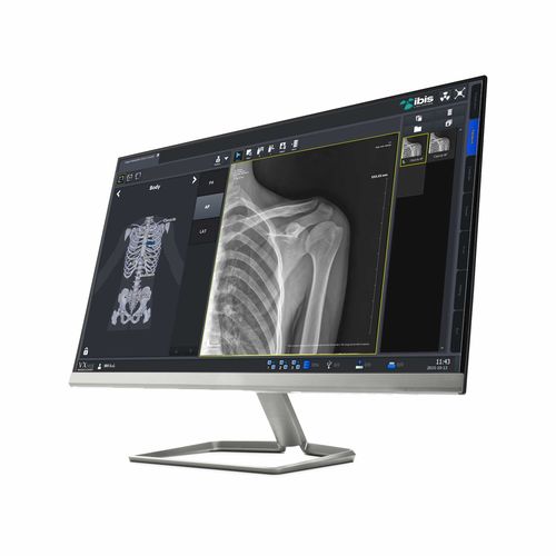 放射学软件 - IBIS X Ray Systems - 查看 / 平板电脑