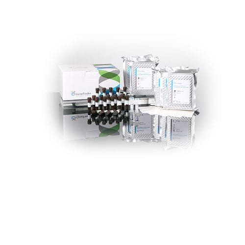 传染病快速诊断套装 - IFMR-10 - OSANG Healthcare/韩国OSANG Healthcare - 抗原 / 血液总量 / 细胞