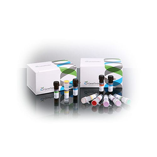 传染病快速诊断套装 - GeneFinder™ - OSANG Healthcare/韩国OSANG Healthcare - 人乳头状瘤病毒 / 阴道分泌物 / PCR