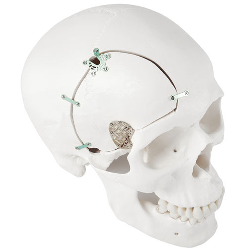 不可吸收颅骨固定系统 - LeForte Neuro 0.3 - Jeil Medical Corporation