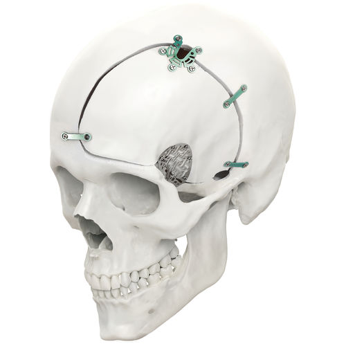 不可吸收颅骨固定系统 - LeForte Neuro 0.6 - Jeil Medical Corporation