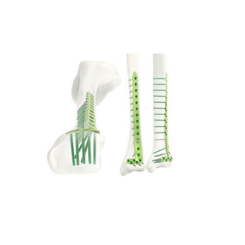 胫骨加压接骨板 - Jeil Medical Corporation - 远侧 / 锁定 / 钛