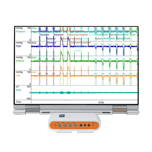 便携式病人监护仪 - Solar™ Go  - Laborie Medical Technologies - 测压法 / 重症监护 / 成人