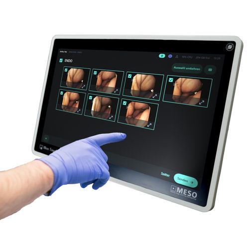 支持DICOM视频记录仪 - IBox Touch - MESO - 医用 / 用于内窥镜 / 高清
