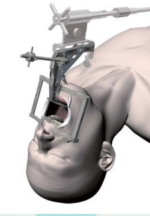 成人咽镜 - Satou - Nagashima Medical Instruments - 直角