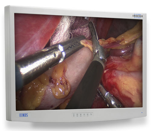 医用监视器 - EndoVue®  - NDS Surgical Imaging - 医学成像 / 内窥镜 / 高解析度