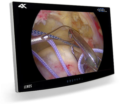 内窥镜监视器 - RADIANCE® ULTRA - NDS Surgical Imaging - 4K分辨率 / HD（高清） / 32"