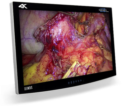 医用监视器 - RADIANCE® ULTRA - NDS Surgical Imaging - 手术 / 4K分辨率 / 32"