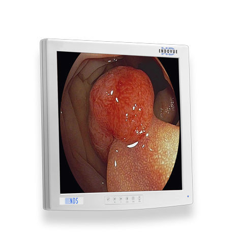 医用监视器 - ENDOVUE® - NDS Surgical Imaging - 医学成像 / 内窥镜 / 高解析度