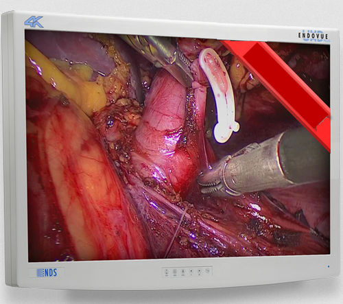 医用监视器 - EndoVue Plus  - NDS Surgical Imaging - 内窥镜 / 高解析度 / 32"