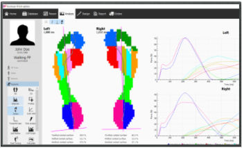 分析软件 - v9 Clinical - Materialise - 测量 / 共享 / 矫正鞋垫设计