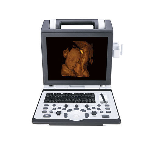 便携式B超机 - Apogee 2100 - SIUI - 用于多功能超声检查 / 彩色多普勒 / 黑白