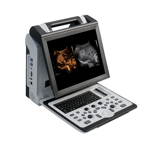 便携式B超机 - Apogee 2300 Pro - SIUI - 用于多功能超声检查 / 用于泌尿科超声检查 / 用于肌肉骨骼超声波