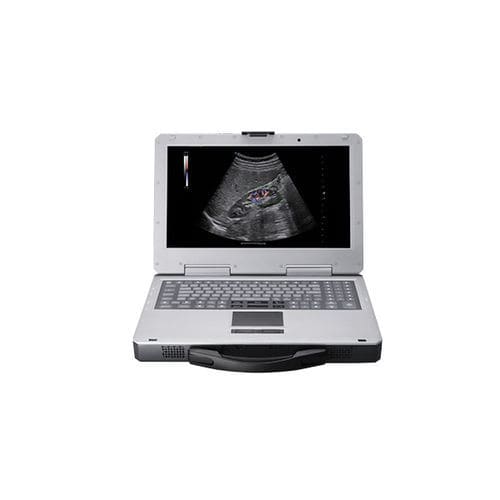 便携式B超机 - Apogee 1000 Plus - SIUI - 用于多功能超声检查 / 彩色多普勒 / 黑白