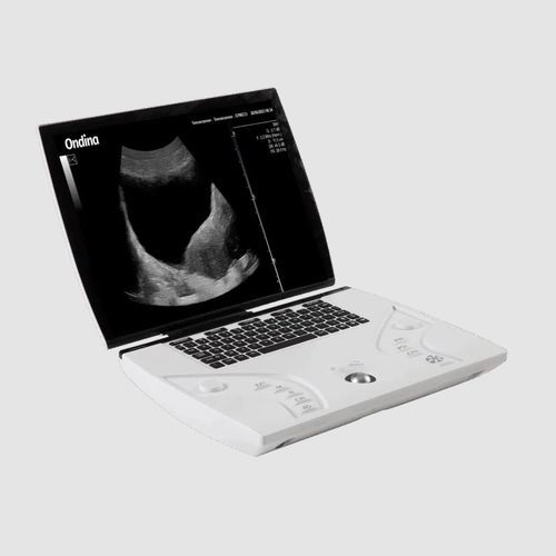 便携式推车B超机 - Orcheo Lite TE - Sonoscanner - 用于多功能超声检查 / 黑白