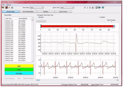 电生理检查软件模块 - CardioPro Infiniti - Thought Technology - 分析