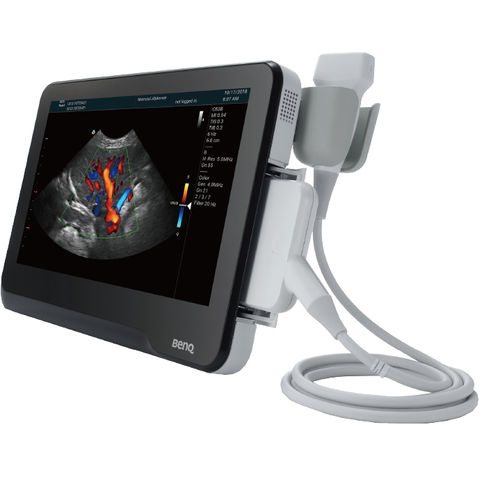 兽医超声波检查仪 / 便携式 - T3300v - BenQ Medical Technology - 多功能 / 小动物 / 犬用