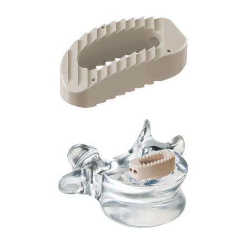 腰骶椎间融合器 - pezo™ - ulrich medical/欧利奇 - 侧方入路 / PEEK材质