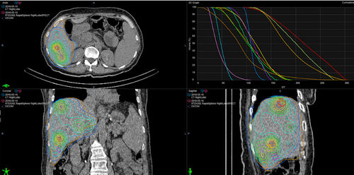 加工软件 - RapidSphere - Varian Oncology/瓦里安 - 带跟踪系统 / 模型制作 / 用于扫描身体轮廓