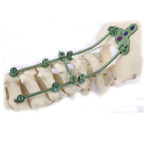 枕颈脊柱内固定系统 - Double Medical Technology - 后入路
