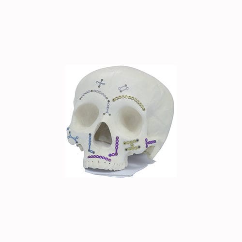 面部肿块加压接骨板 - Double Medical Technology - 金属