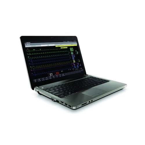查看软件 - BeneVision CMS  - Mindray North America/迈瑞 - 管理线上 ECG 工作流程管理 / 报警 / 用于个人文件