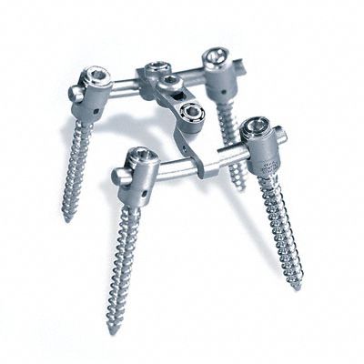 胸腰椎脊柱内固定系统 - S4®   - Aesculap®/贝朗 - 后入路