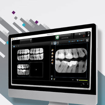 医疗可视化软件 - CS Imaging version 8 - Carestream Dental/锐珂 - 数据管理 / 病人信息管理 / 诊断