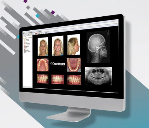 牙科软件 - CS Orthodontic Imaging Software - Carestream Dental/锐珂 - 牙齿矫正 / 病人信息管理 / 图像分析