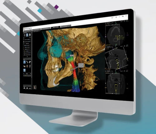分析软件模块 - CS Airway - Carestream Dental/锐珂 - 测量 / 3D 可视化 / 加工