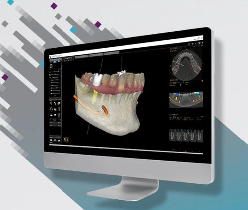 临床软件 - CS 3D - Carestream Dental/锐珂 - 解剖学 / 牙科 / 口腔移植手术