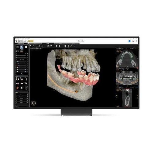临床软件 - CS 3D Imaging Premium - Carestream Dental/锐珂 - 牙科 / 口腔移植手术 / 牙科手术