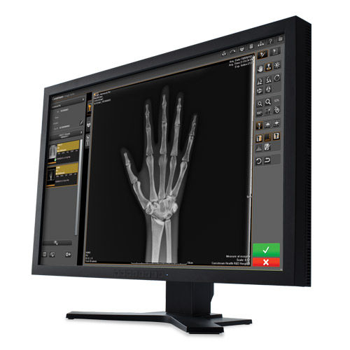 医学影像软件 - Image Suite V4 - Carestream - 分析 / 管理 / 可视化