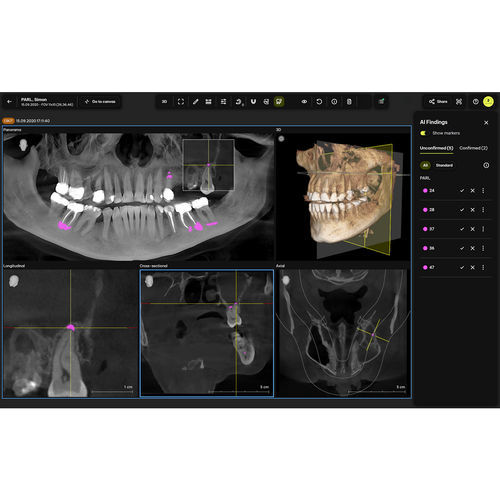 医学诊断软件 - Smart View – Detect - Dentsply Sirona/登士柏西诺德 - 协助 / 放射学 / 牙齿