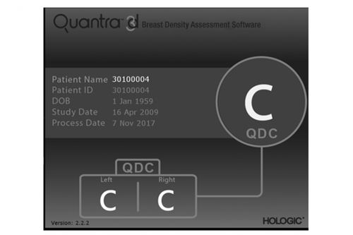 乳腺X射线造影软件 - Quantra™ - Hologic - 医用 / 报告 / CAD