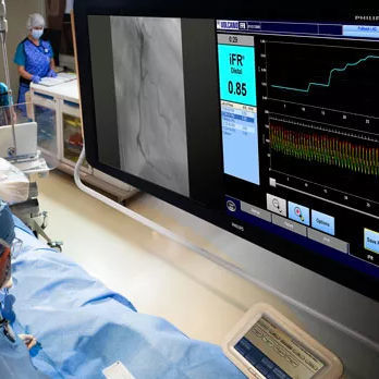 心血管显示器 - FlexVision XL - Philips Healthcare/飞利浦 - 高解析度 / 58" / 液晶