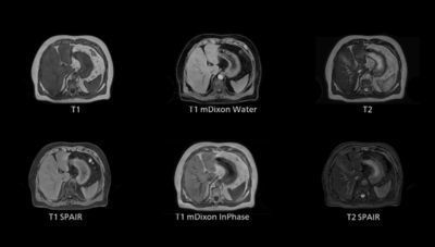 模拟软件 - 4D MR-RT - Philips Healthcare/飞利浦 - 用于扫描身体轮廓 / 治疗计划制定 / 医用