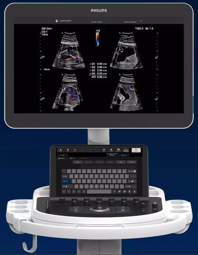 便携式推车B超机 - Elevate Plus - Philips Healthcare/飞利浦 - 用于多功能超声检查 / 黑白 / 触摸屏