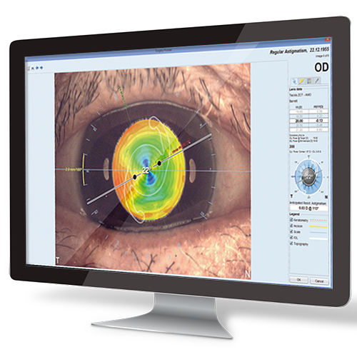 医院软件 - EyeSuite IOL  - Haag-Streit Diagnostics - 解剖学 / 眼科手术 / 测量