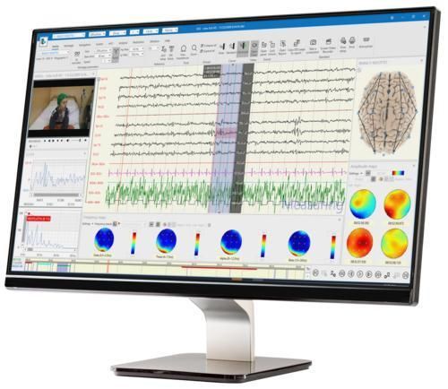 可视化管理、分析系统 - BRAIN QUICK® - Natus Hearing & Balance - DICOM文件 / 诊断 / 信号