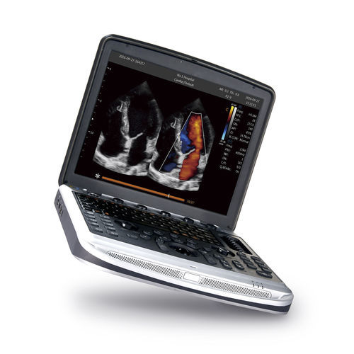 便携式B超机 - SonoBook 9 - CHISON Medical Technologies/祥生 - 用于多功能超声检查 / 妇产科用超声成像 / 用于心血管超声检查