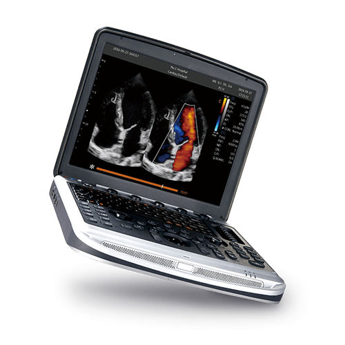 便携式B超机 - SonoBook 8 - CHISON Medical Technologies/祥生 - 用于多功能超声检查 / 黑白 / 彩色多普勒