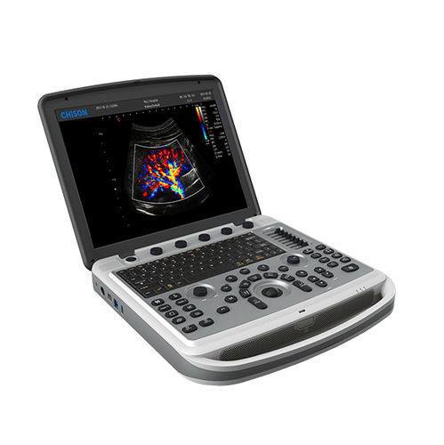 兽医超声波检查仪 / 便携式 - SonoBook 6 - CHISON Medical Technologies/祥生 - 多功能 / 黑白 / 彩色多普勒